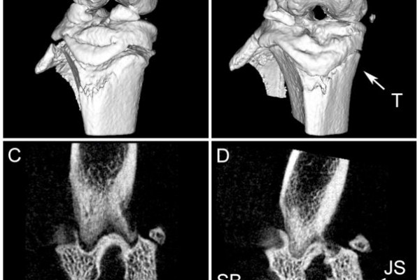 In Vivo Small Animal Imaging using Micro-CT and Digital Subtraction Angiography